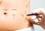 cirurgia-plastica-barueri-1452541586