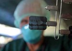 radiografia-odontologia-barueri-1452624889