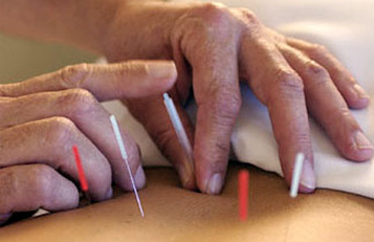 ES Acupuntura Alphaville - Foto 1